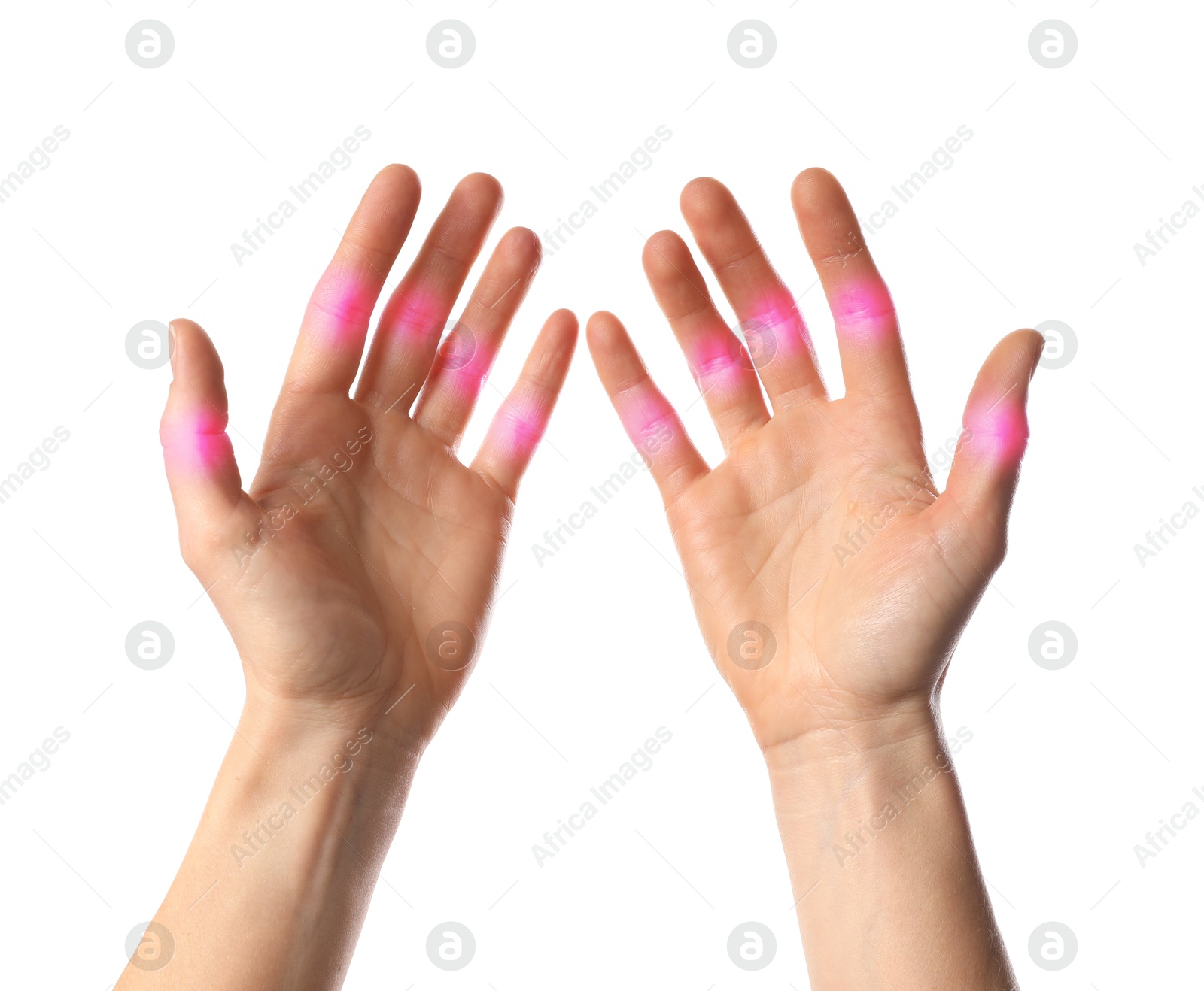 Image of Woman with joint inflammation on white background, closeup. Highlighted areas on fingers