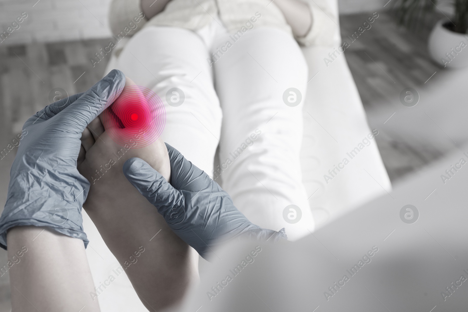 Image of Joint inflammation. Doctor checking woman's foot at hospital, closeup. Toned in black-and-white with color area on toe