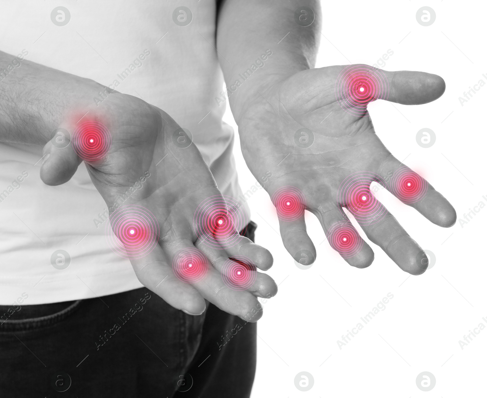 Image of Man with joint inflammation on white background, closeup. Toned in black-and-white with color areas on fingers