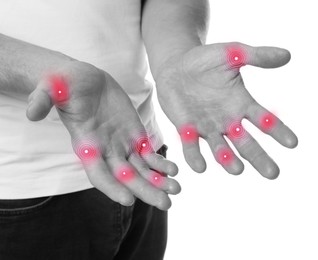 Image of Man with joint inflammation on white background, closeup. Toned in black-and-white with color areas on fingers