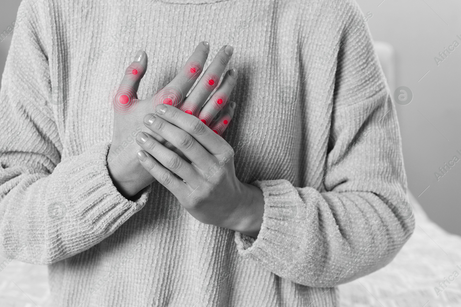 Image of Woman with joint inflammation indoors, closeup. Toned in black-and-white with color areas on fingers