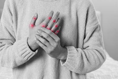 Image of Woman with joint inflammation indoors, closeup. Toned in black-and-white with color areas on fingers