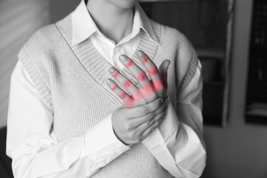 Image of Woman with joint inflammation indoors, closeup. Toned in black-and-white with color areas on fingers