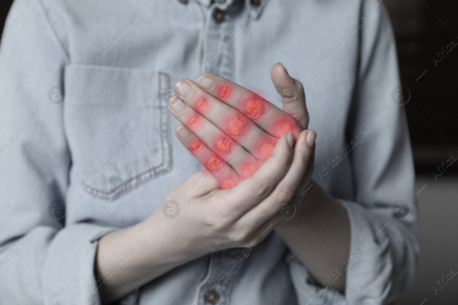 Image of Woman with joint inflammation indoors, closeup. Toned in black-and-white with color areas on fingers