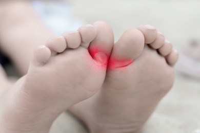 Image of Woman with joint inflammation, closeup. Highlighted areas on toes