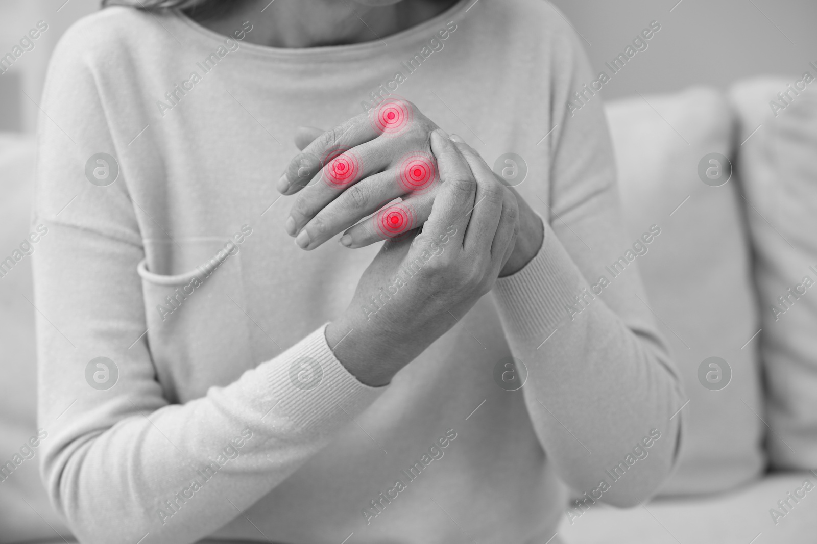 Image of Woman with joint inflammation indoors, closeup. Toned in black-and-white with color areas on fingers