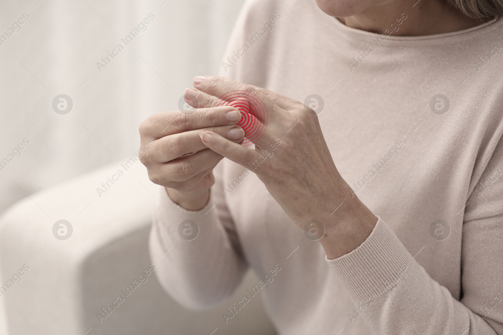 Image of Woman with joint inflammation indoors, closeup. Red area on finger