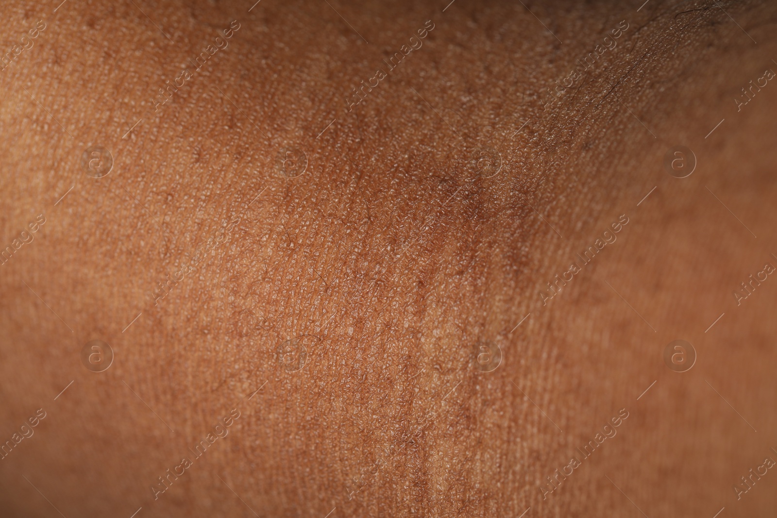 Photo of Macro view of normal skin as background