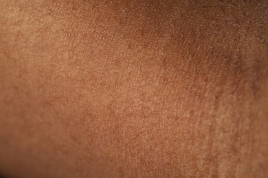 Photo of Macro view of normal skin as background