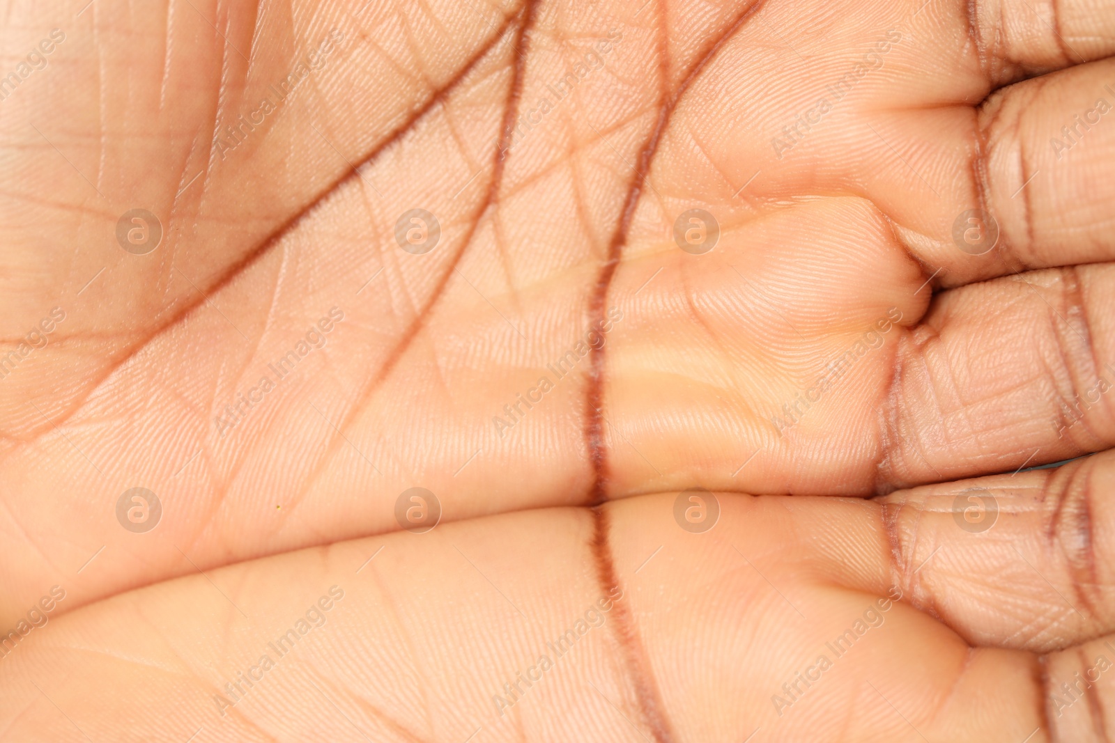 Photo of Macro view of normal skin as background