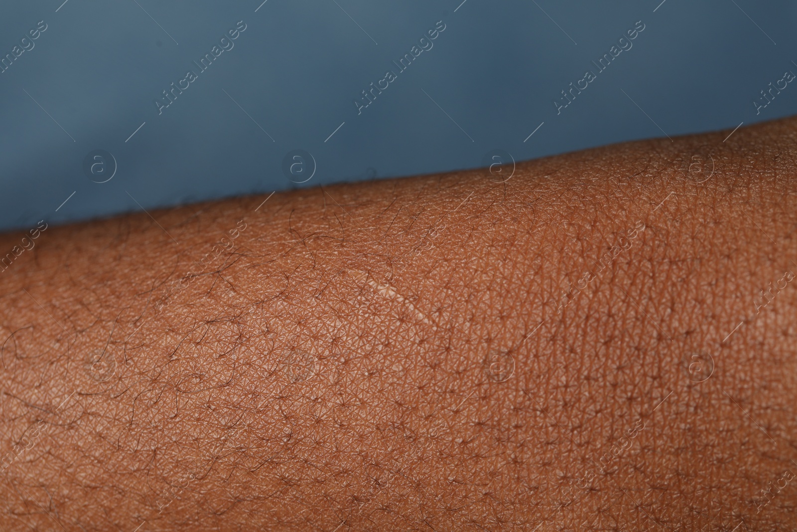 Photo of Macro view of normal skin on blue background