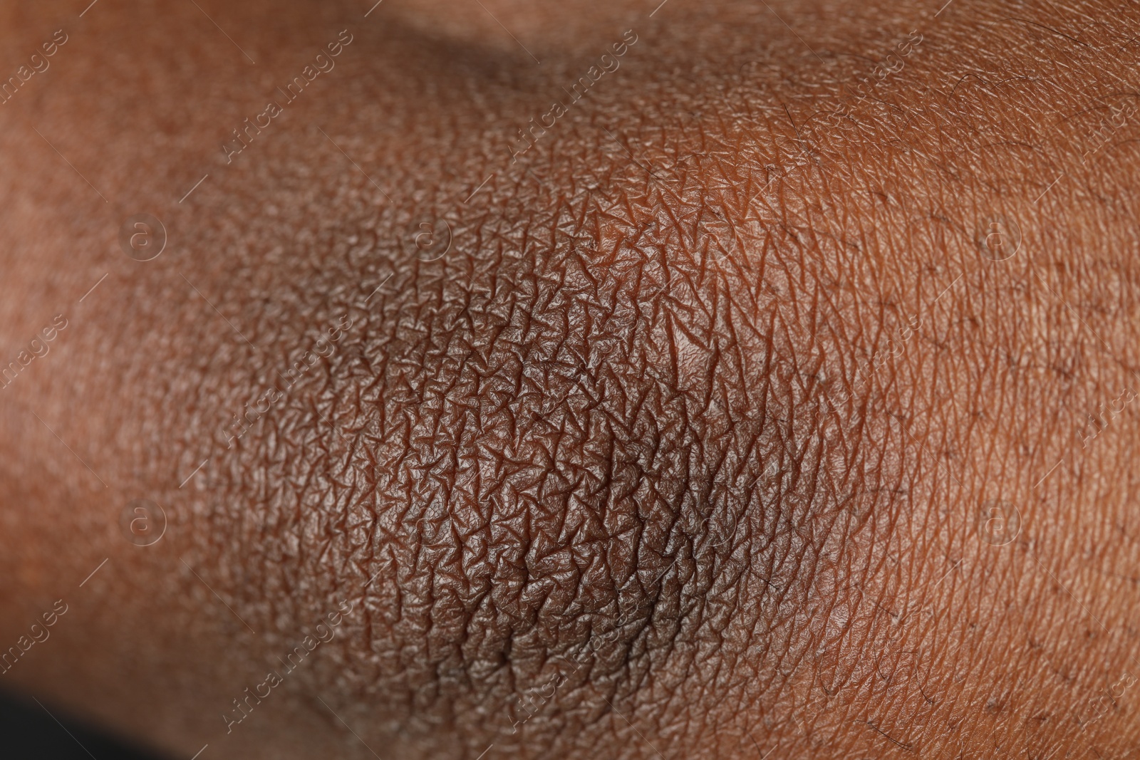 Photo of Macro view of normal skin as background