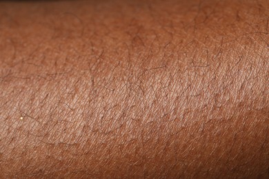 Photo of Macro view of normal skin as background