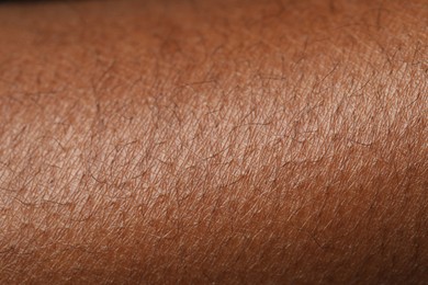 Photo of Macro view of normal skin as background