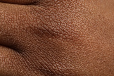 Photo of Macro view of normal skin as background