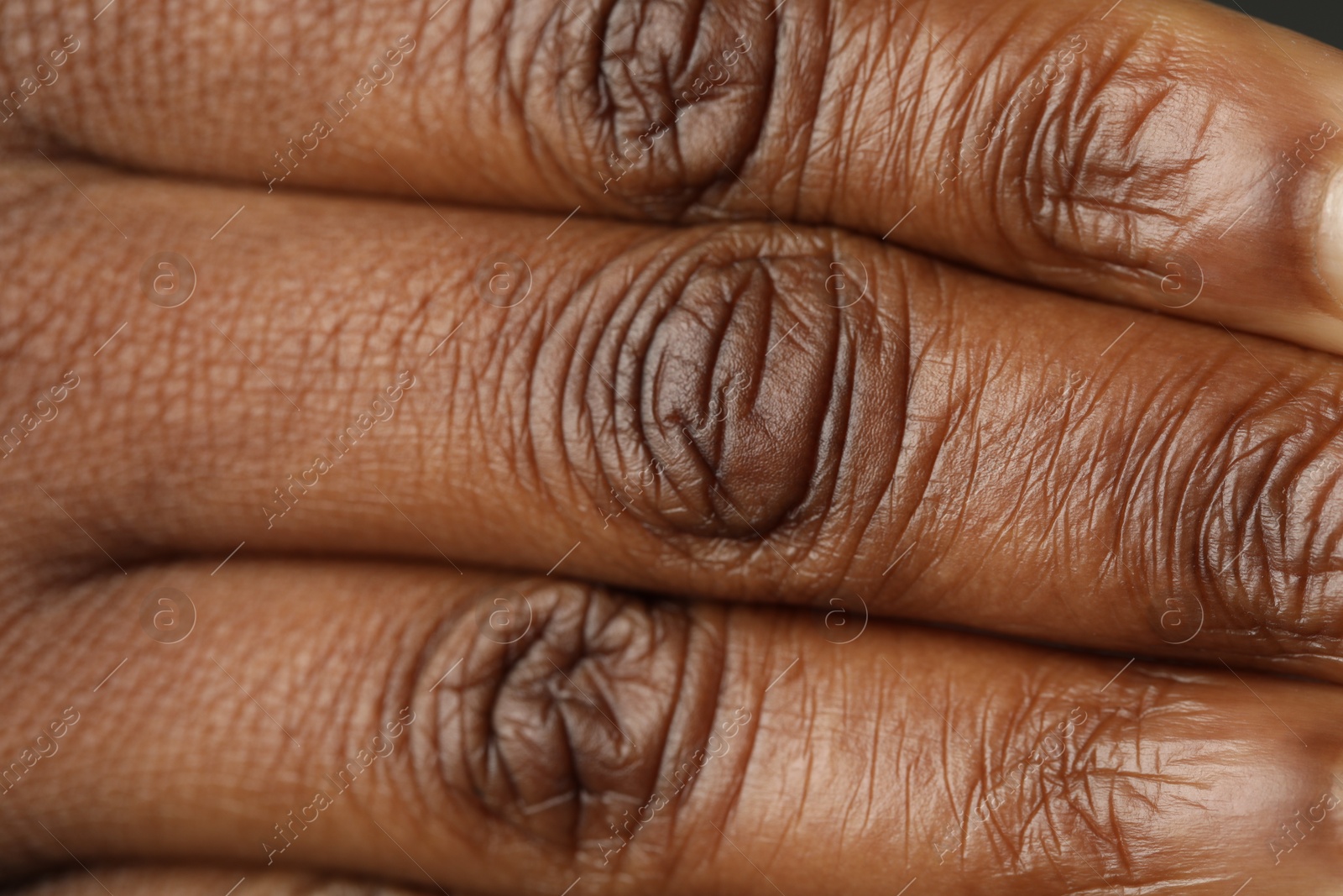 Photo of Macro view of normal skin as background