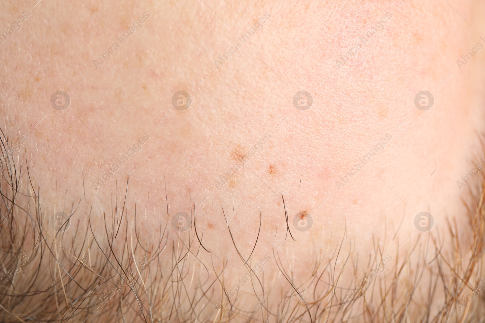 Photo of Texture of normal skin as background, closeup