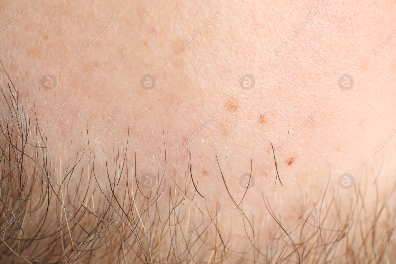 Photo of Texture of normal skin as background, closeup