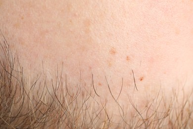 Photo of Texture of normal skin as background, closeup