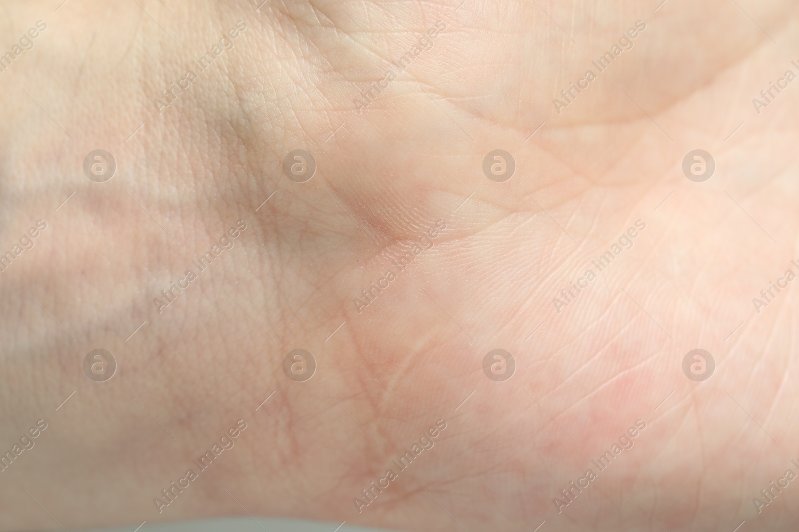 Photo of Texture of normal skin as background, closeup