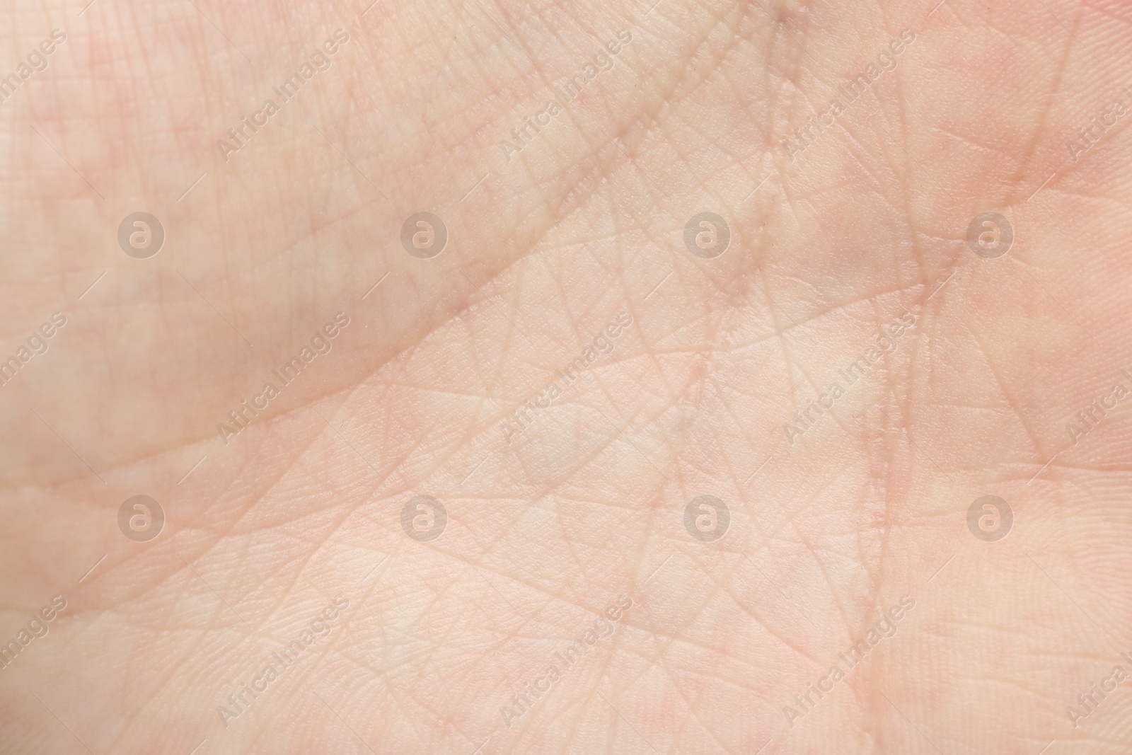 Photo of Texture of normal skin as background, closeup