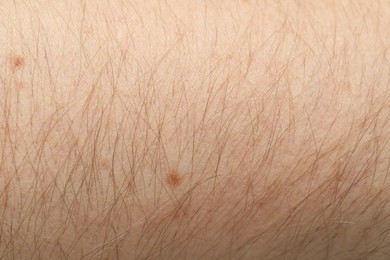 Photo of Texture of normal skin as background, closeup