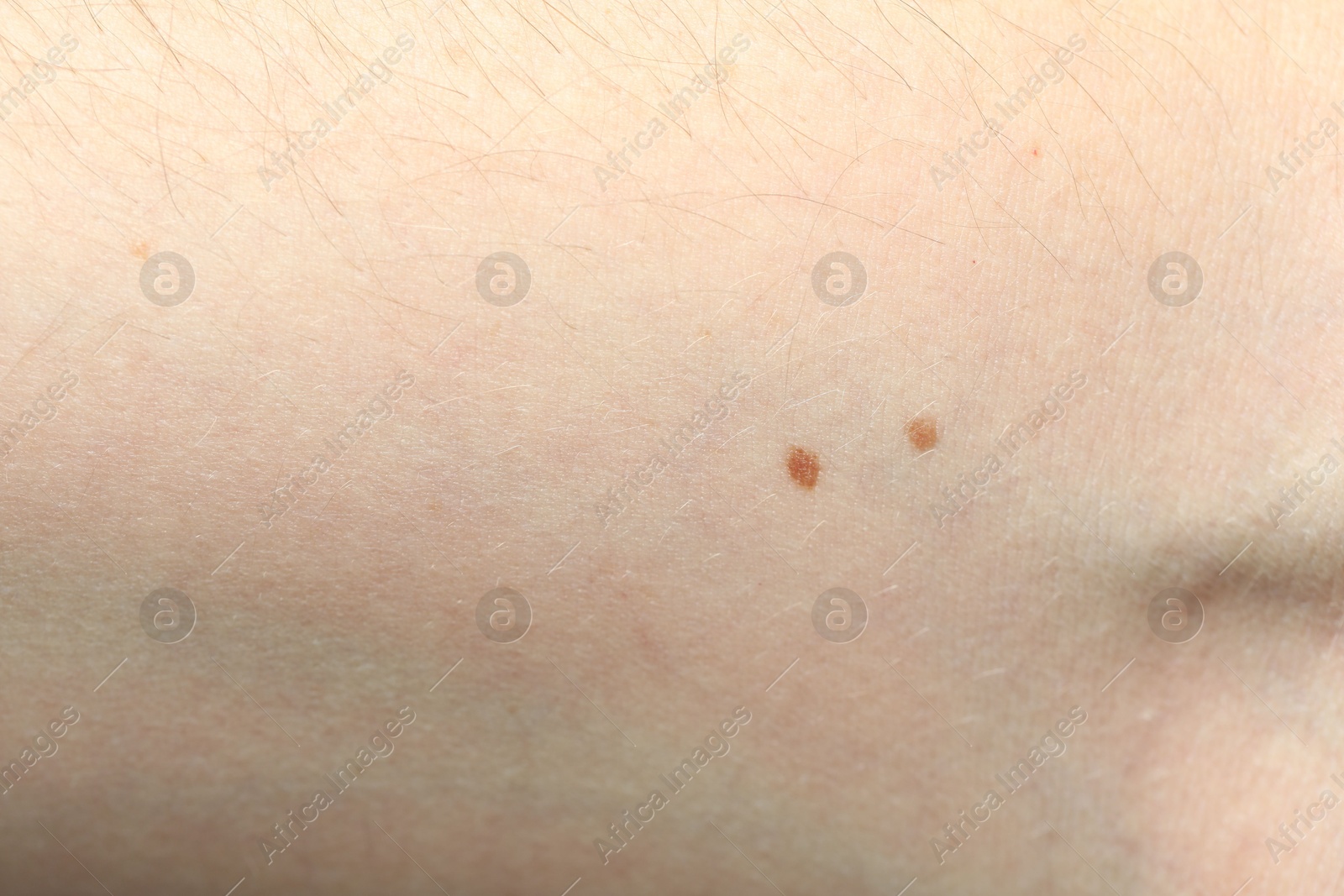 Photo of Texture of normal skin as background, closeup