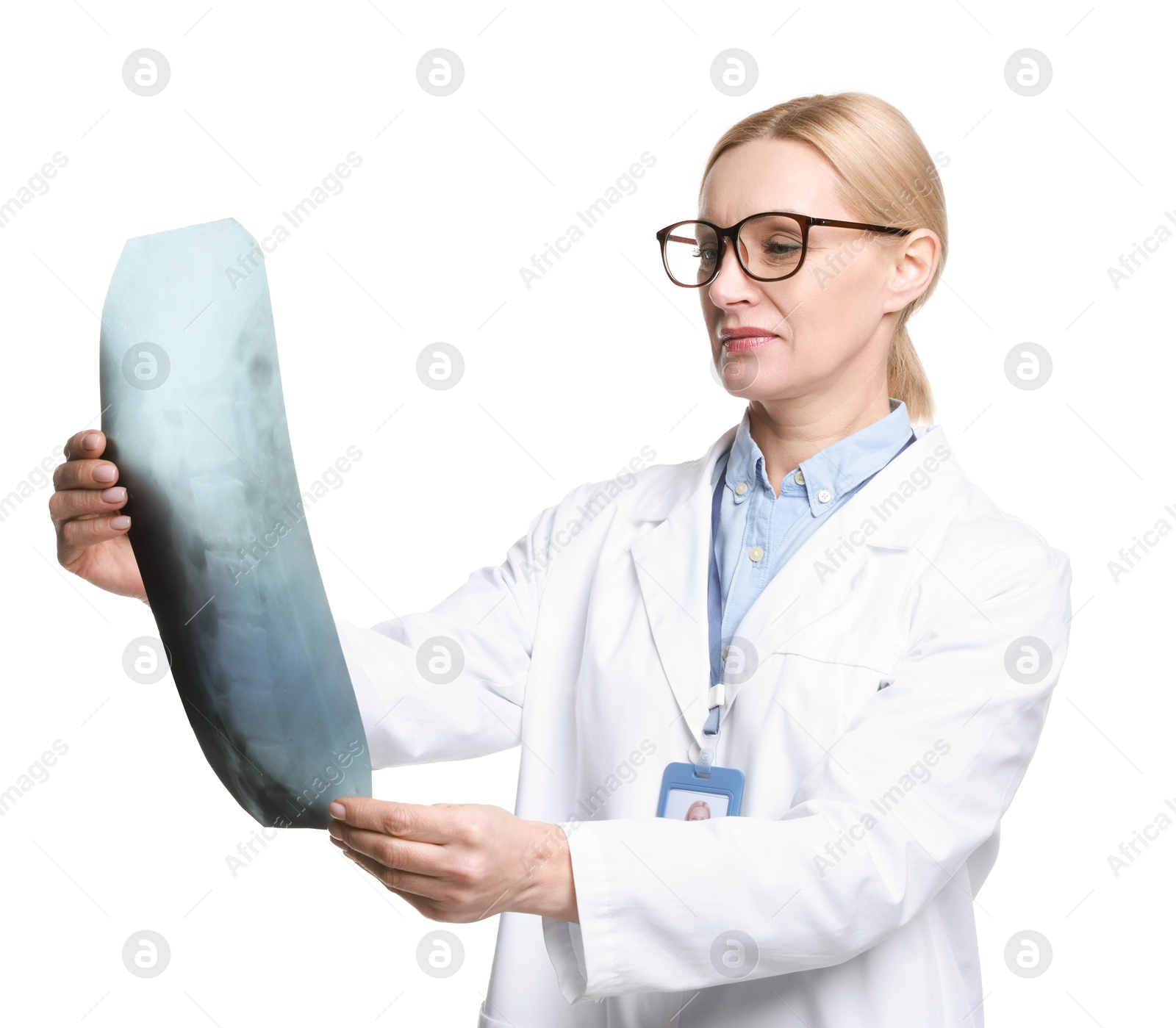 Photo of Doctor examining backbone x-ray on white background