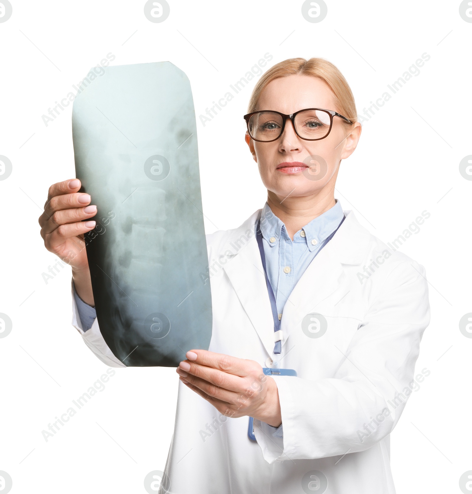 Photo of Doctor examining backbone x-ray on white background