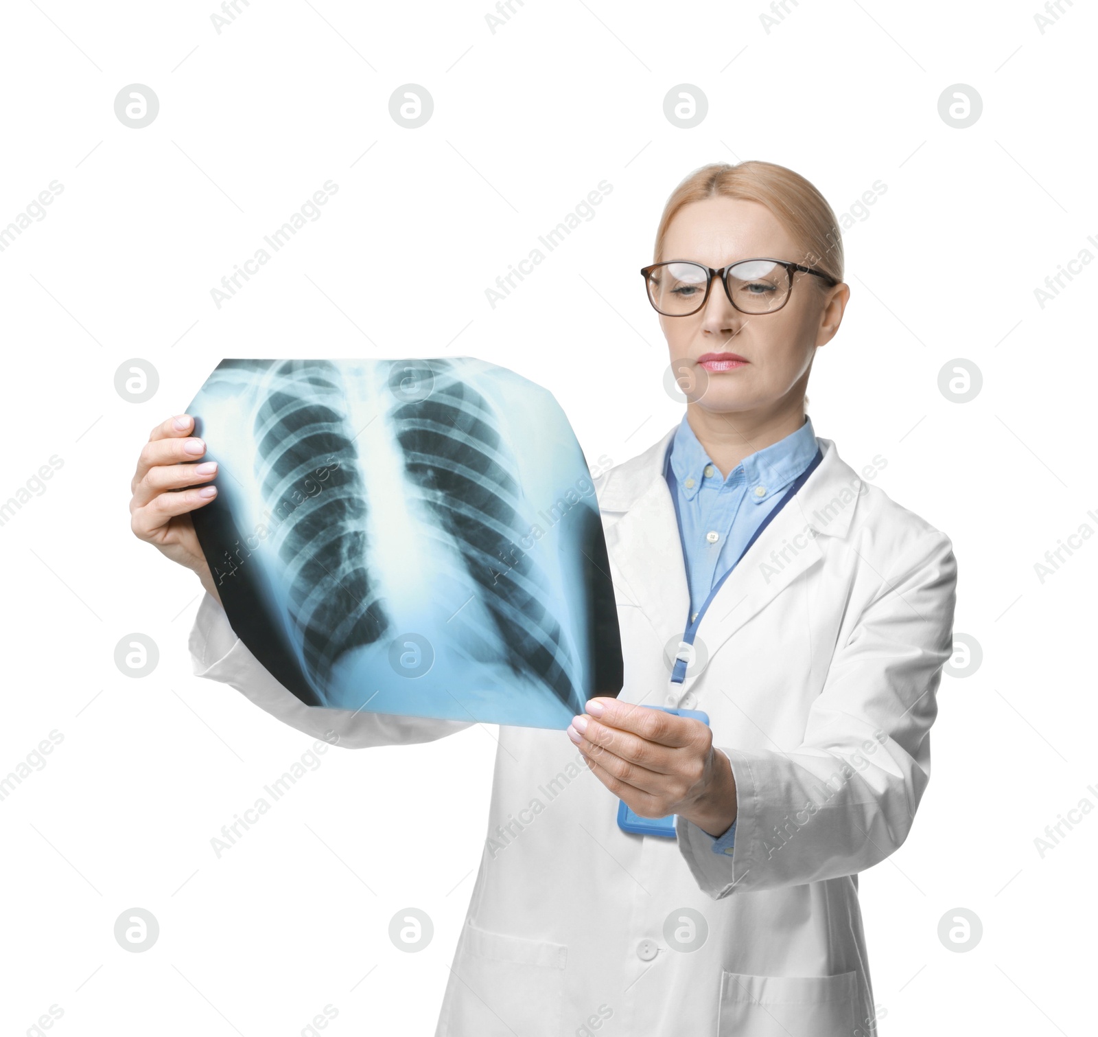 Photo of Doctor examining chest x-ray on white background