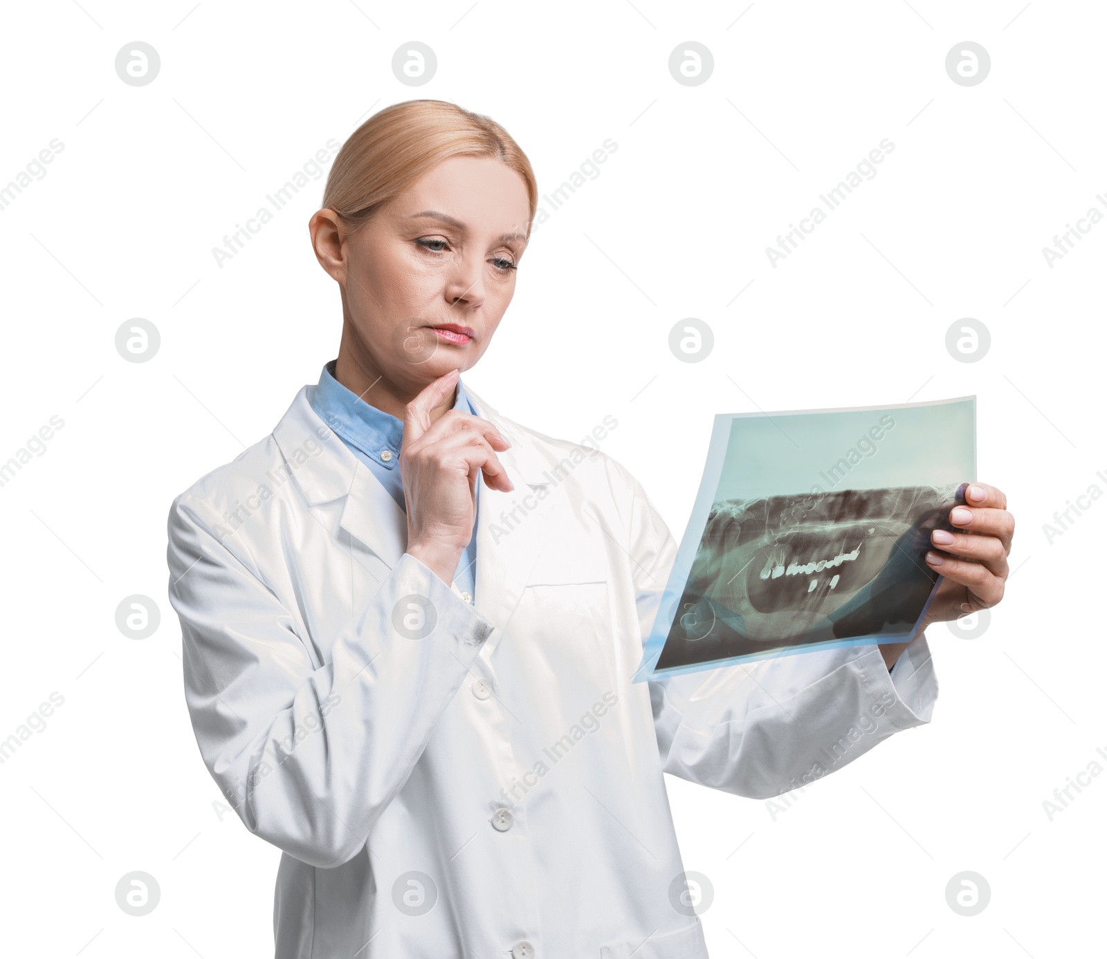 Photo of Doctor examining x-ray image on white background