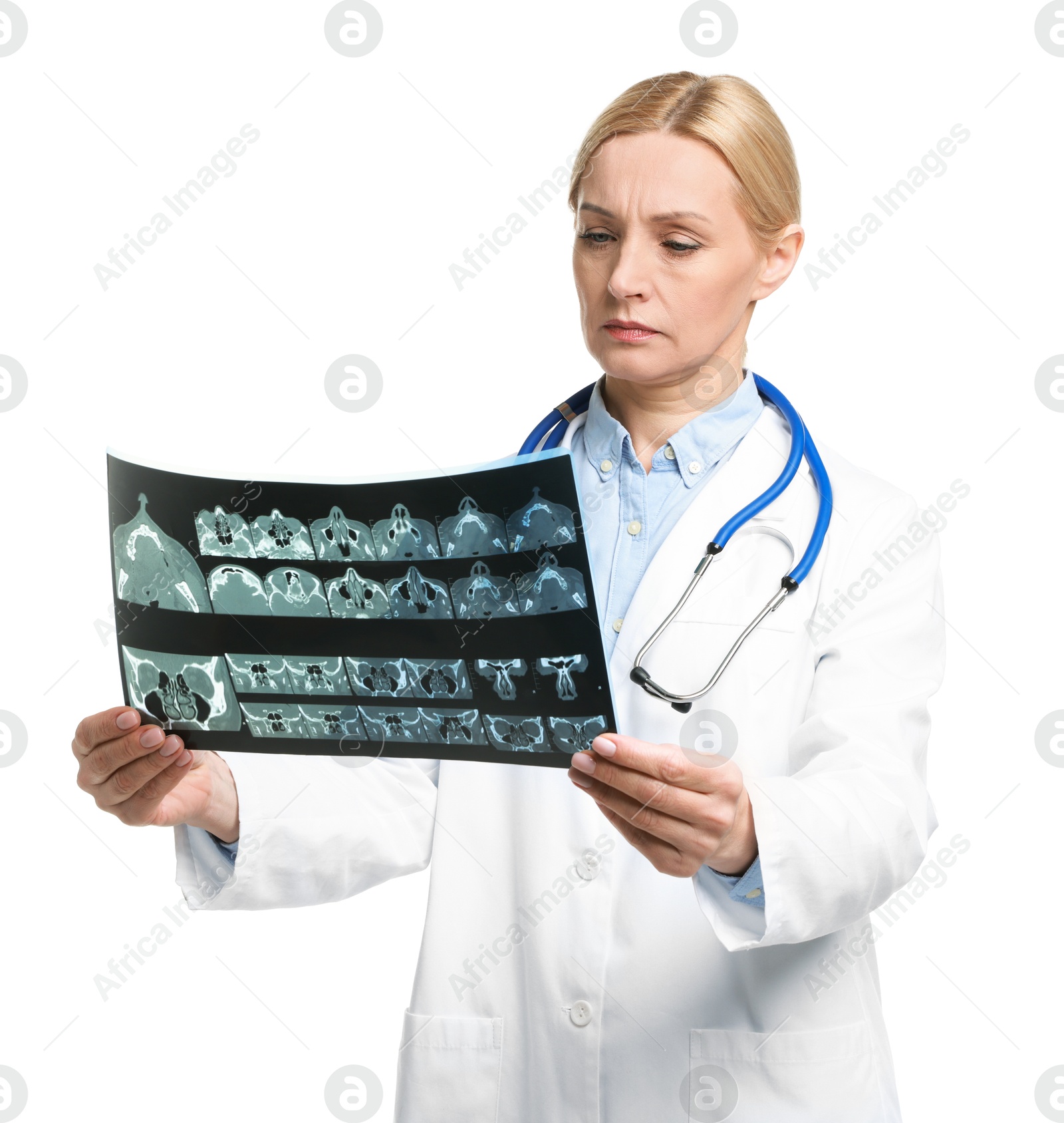 Photo of Doctor examining x-ray image of paranasal sinuses on white background