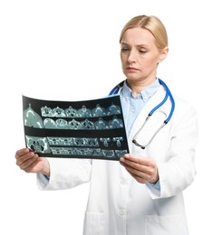 Photo of Doctor examining x-ray image of paranasal sinuses on white background