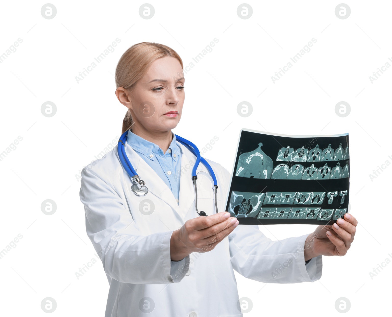 Photo of Doctor examining x-ray image of paranasal sinuses on white background