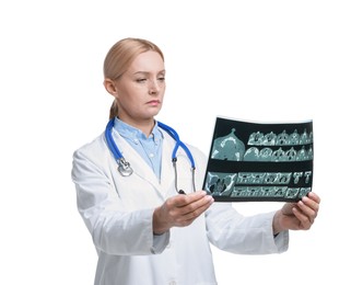 Photo of Doctor examining x-ray image of paranasal sinuses on white background