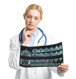 Doctor examining x-ray image of paranasal sinuses on white background