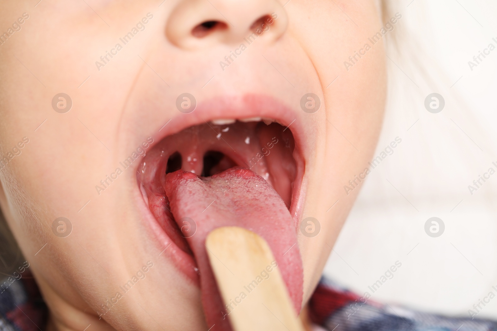 Photo of Examining girl's throat with tongue depressor on light background, closeup