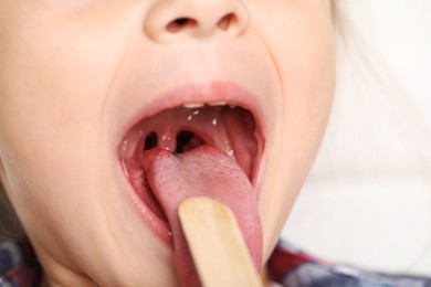 Photo of Examining girl's throat with tongue depressor on light background, closeup