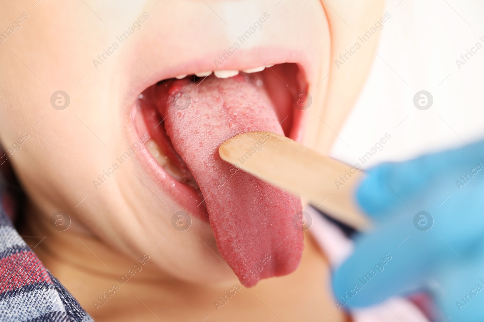 Photo of Doctor examining girl's throat with tongue depressor in clinic, closeup