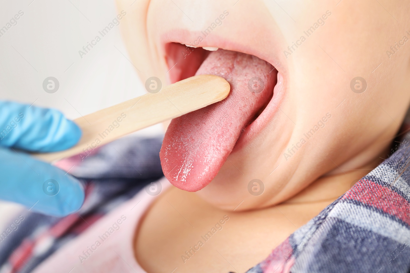 Photo of Doctor examining girl's throat with tongue depressor in clinic, closeup