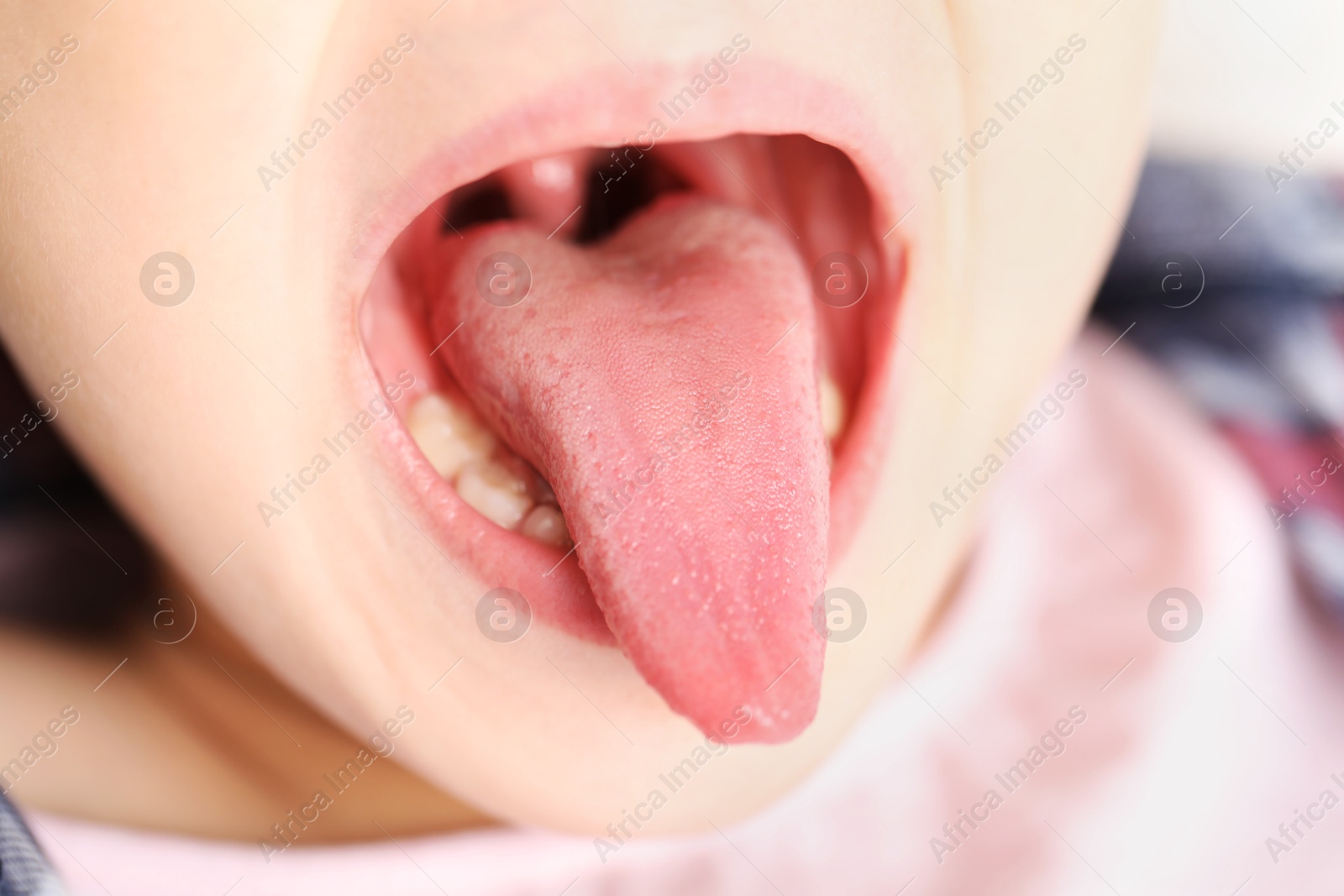 Photo of Closeup view of girl showing her tongue