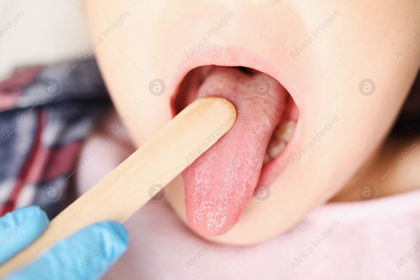 Photo of Doctor examining girl's throat with tongue depressor in clinic, closeup