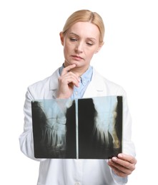 Photo of Doctor examining foot x-ray on white background