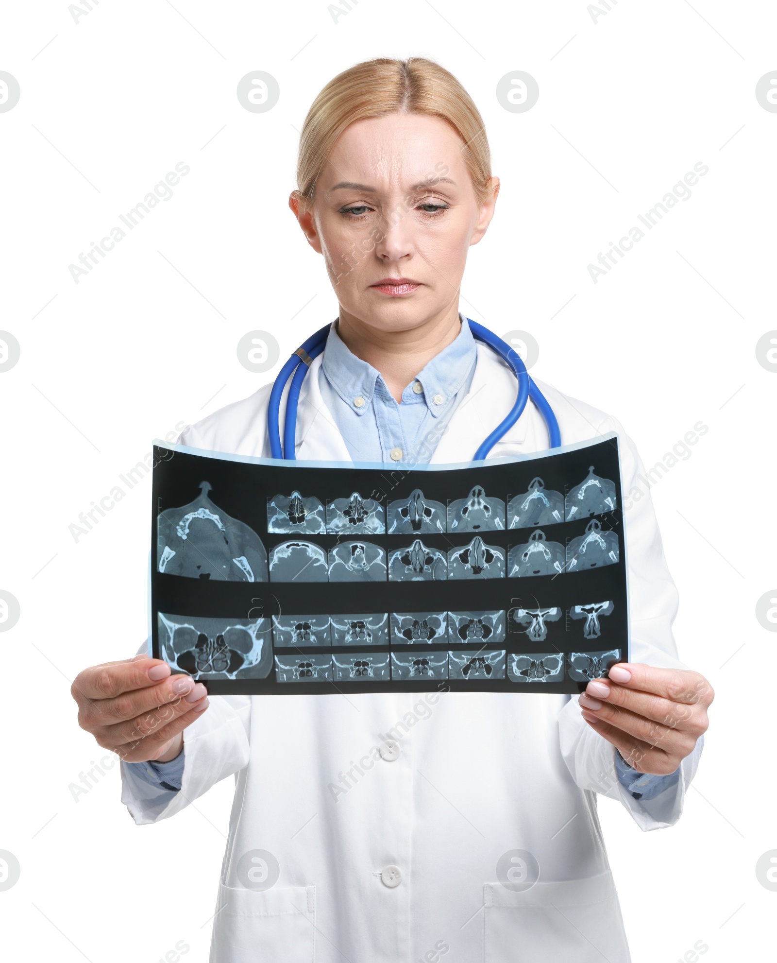 Photo of Doctor examining x-ray image of paranasal sinuses on white background