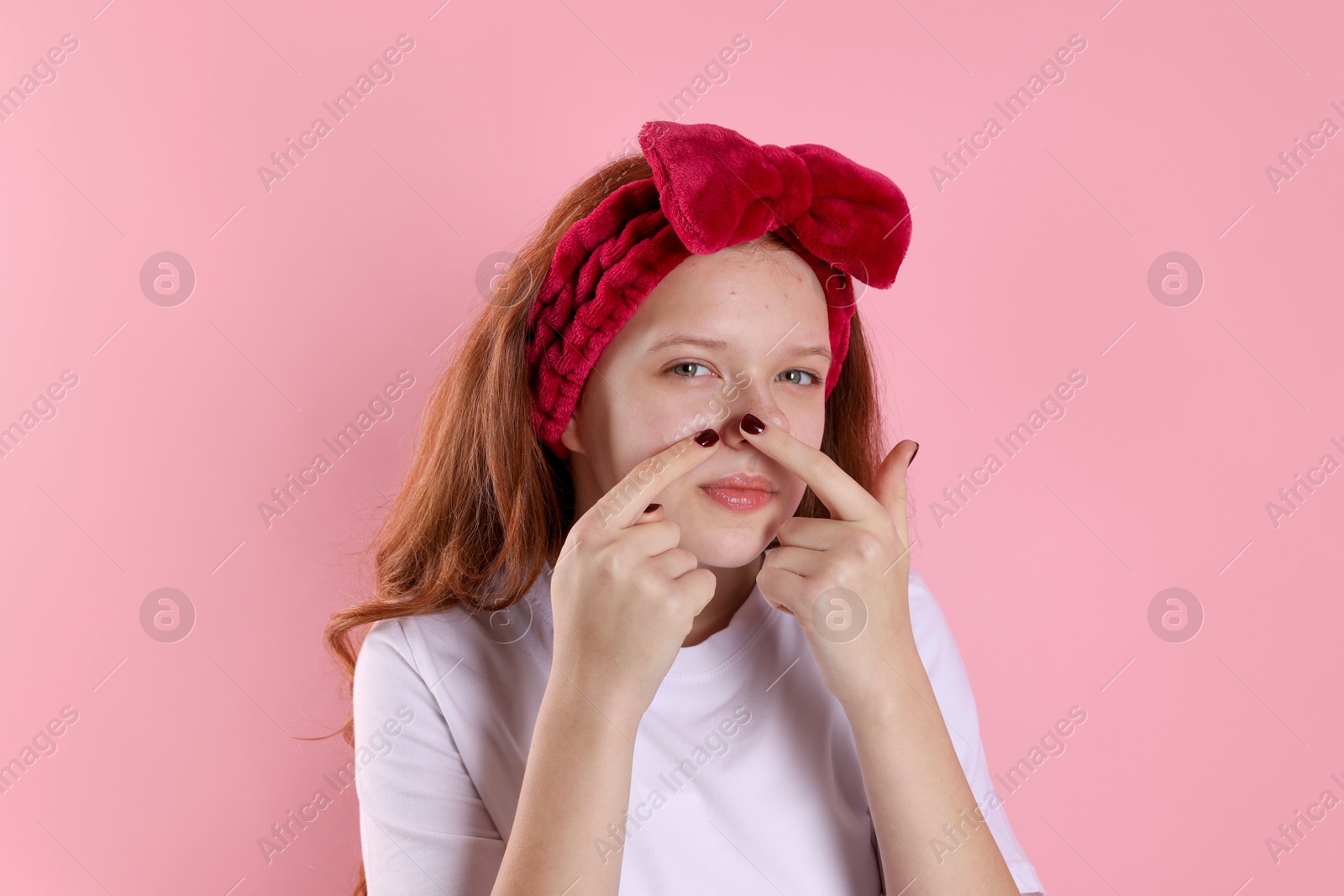 Photo of Teenage girl popping pimple on her face against pink background. Acne problem