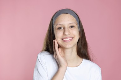 Photo of Teenage girl with acne problem on pink background