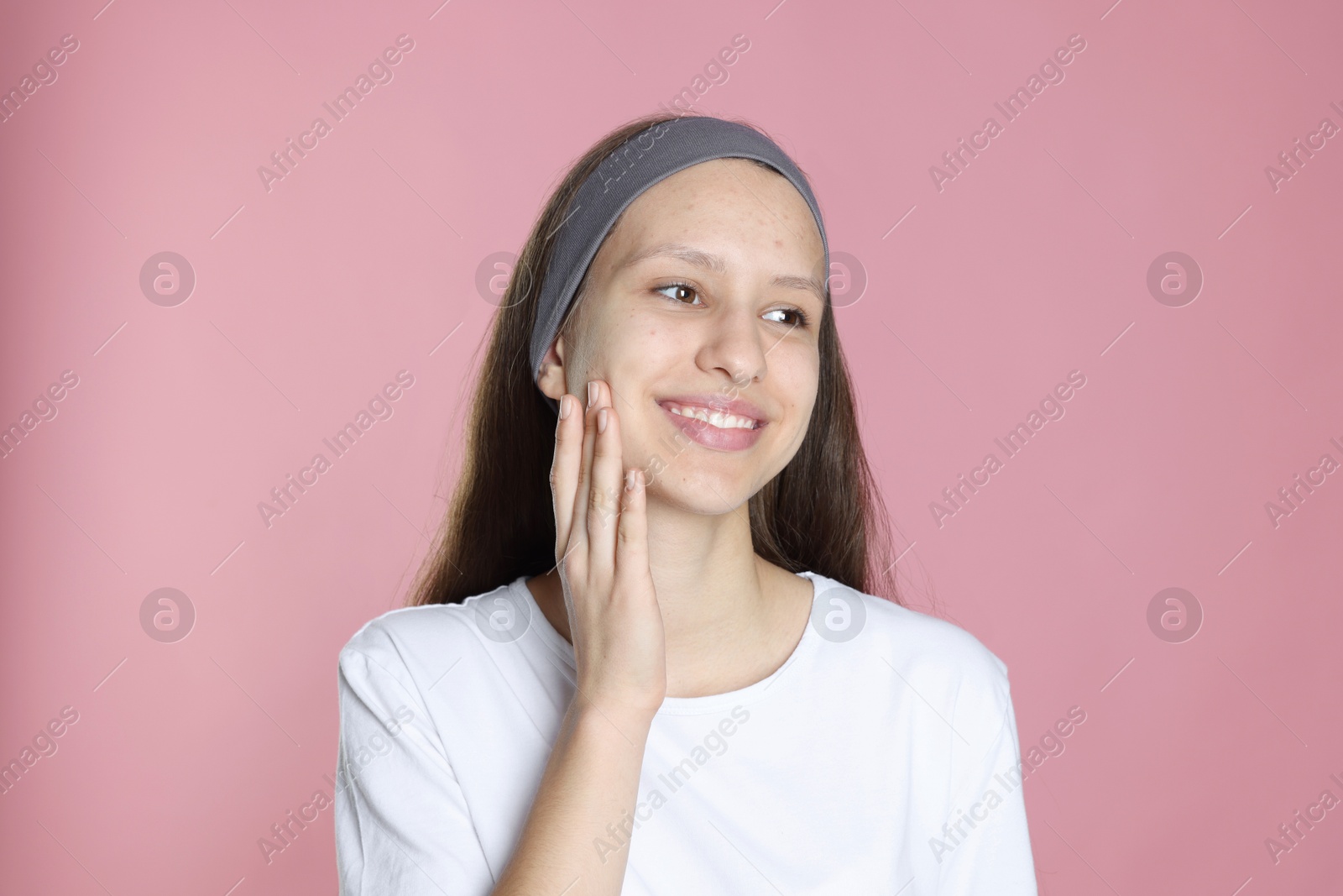 Photo of Teenage girl with acne problem on pink background