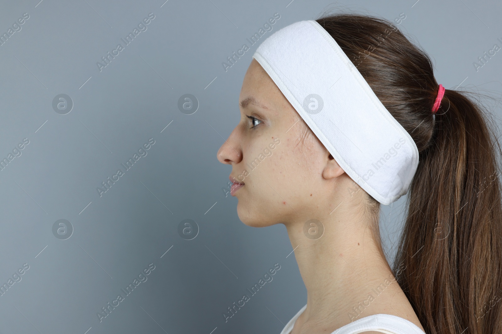 Photo of Teenage girl with acne problem on grey background. Space for text