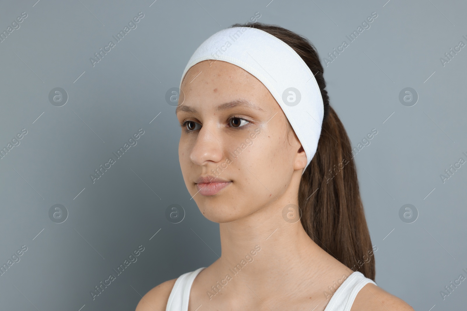 Photo of Teenage girl with acne problem on grey background