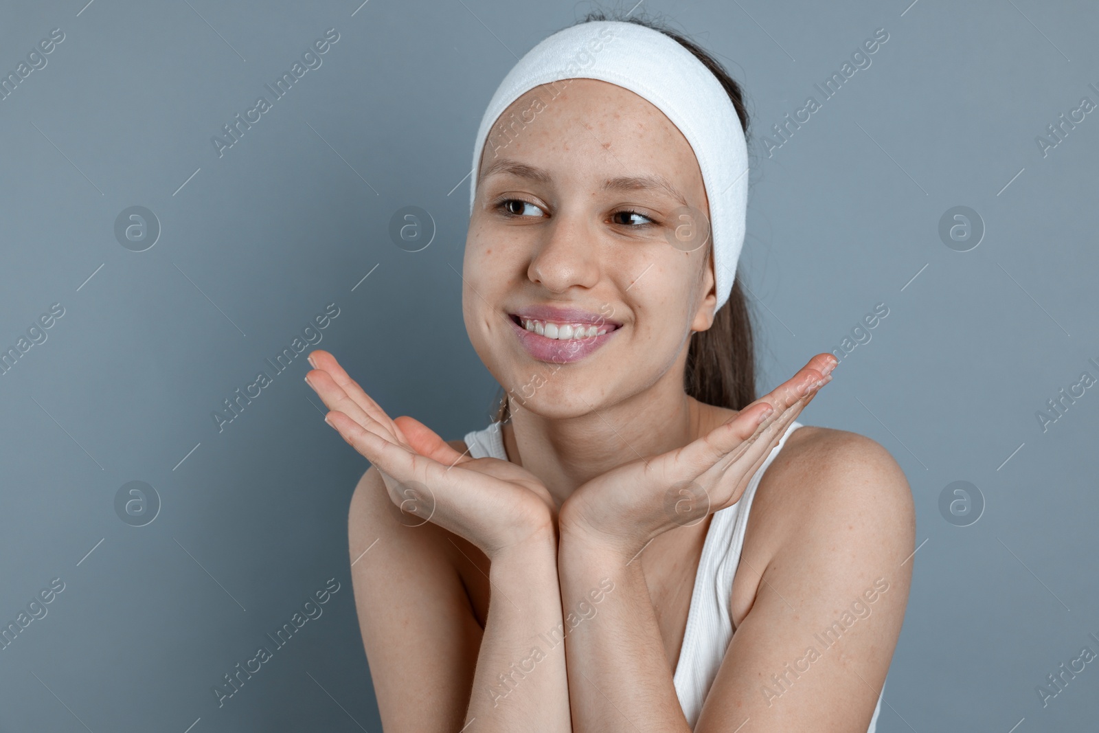 Photo of Teenage girl with acne problem on grey background